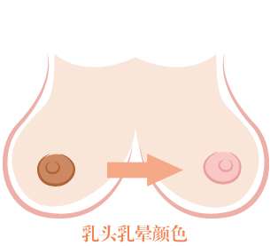 乳晕 乳晕
